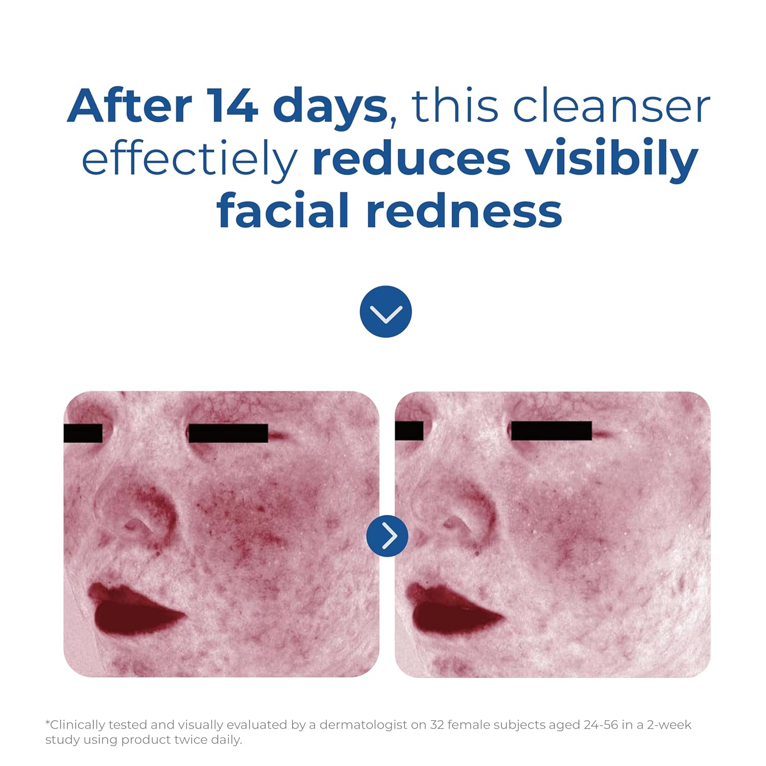Skin_Recovery_Cleanser_6.jpg